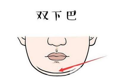 双下巴怎么减