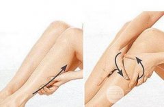 瘦小腿手术方法汇总盘点 打造“竹竿腿”