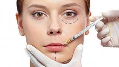 生物注射除皱是什么东西 多少费用勒