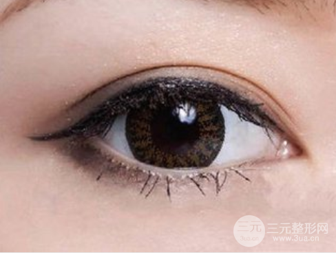 肿泡眼割双眼皮