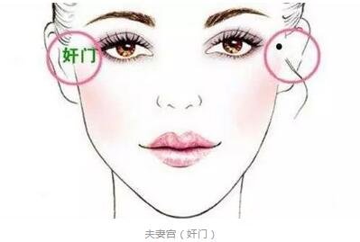 注射玻尿酸丰太阳穴