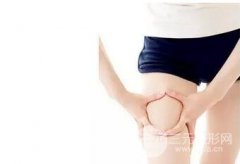 大腿吸脂减肥真的有那么阔怕么 深度了解