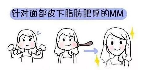 脸部吸脂减肥