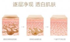 复合彩光去痘会反弹吗?价格是多少?