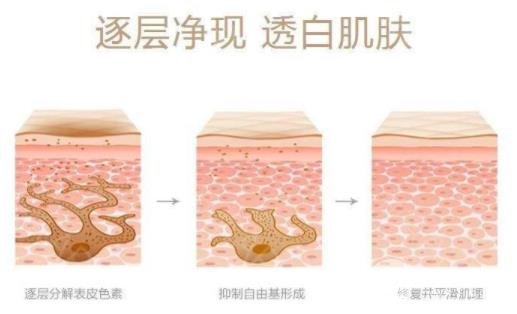 复合彩光祛痘反弹