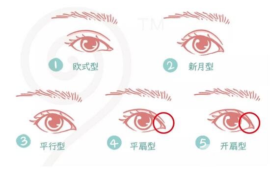 开扇双眼皮