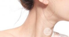 怎么祛除颈纹方法大盘点 避免这些鸡肋
