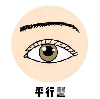内双割双眼皮
