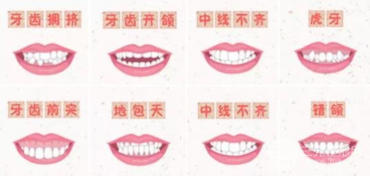 柳州牙齿矫正方法