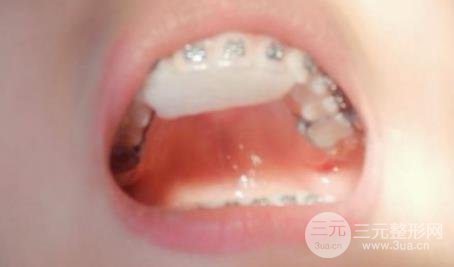 上海九院矫正费用