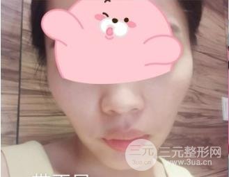 上海九院整牙价格