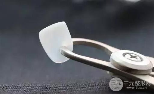 牙贴面价格