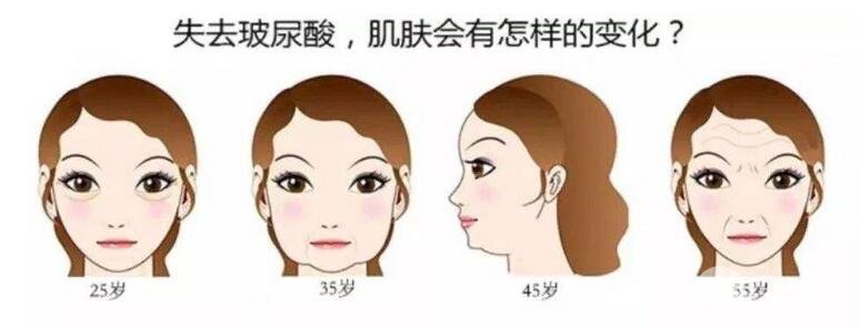 注射除皱美容