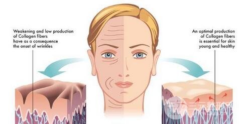 超音波拉皮的价格是多少 没人告诉你的三件事