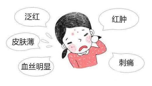 怎么样可以去掉红血丝