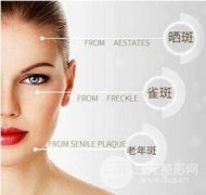 一次性祛斑用什么方法较好 医美知识科普~