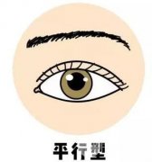 好看的四种双眼皮 看看你属于哪一类