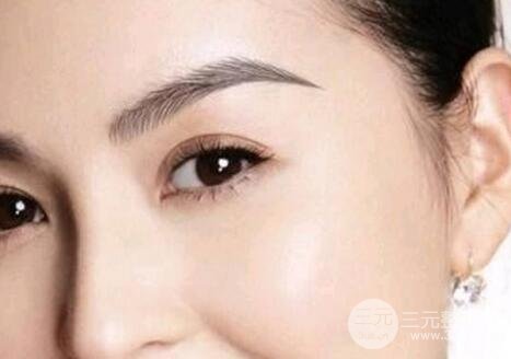 新月型双眼皮适合什么人