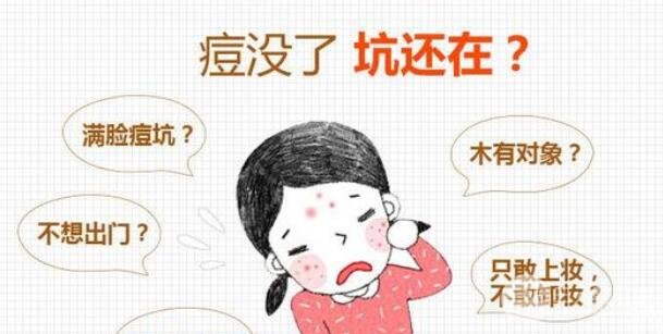 激光缓解痘疤有吗