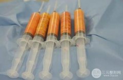 脂肪填充额头太阳穴两个部位大概要多少钱? 脂肪填充额头太阳穴两个部位大概要多少钱?