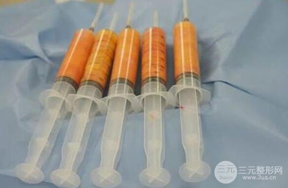 脂肪填充额头太阳穴两个部位大概要多少钱？