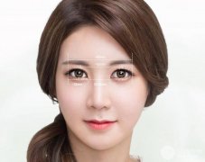 关于切开双眼皮的误解