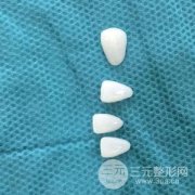 上海九院口腔科种植牙齿多少钱 果好不好
