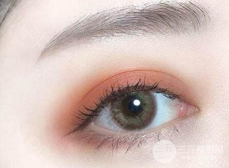成都割双眼皮价钱贵不贵 注意事项详解