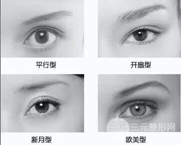 双眼皮做哪种好