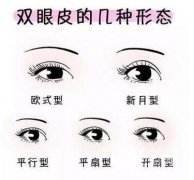 扇形双眼皮和平行双眼皮哪个好看 看看你适合哪种