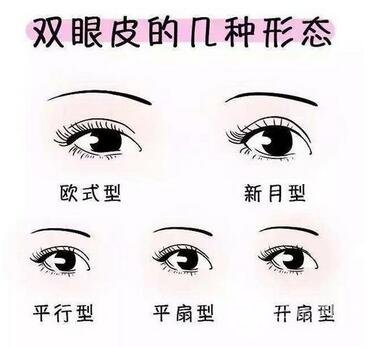 扇形双眼皮