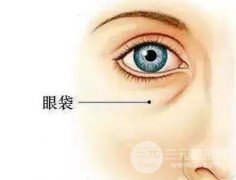 成都内切祛眼袋手术要多少钱 科普篇