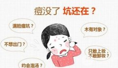 激光祛痘坑多少钱 北京协和医院专家解说