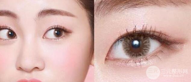 开眼尾和开眼角区别在哪里