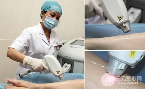 西安西京医院脱毛价格