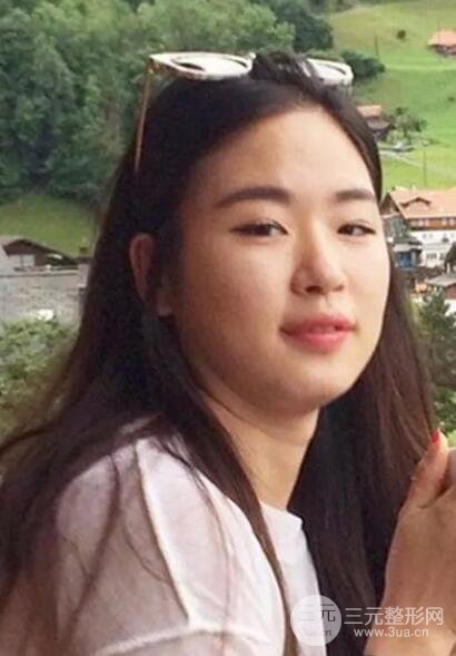 怎么才能减双下巴