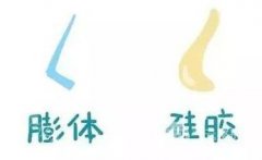 成都假体隆鼻整形价码表2020版精彩全新上架 成都假体隆鼻整形价码表2020版精彩全新上架