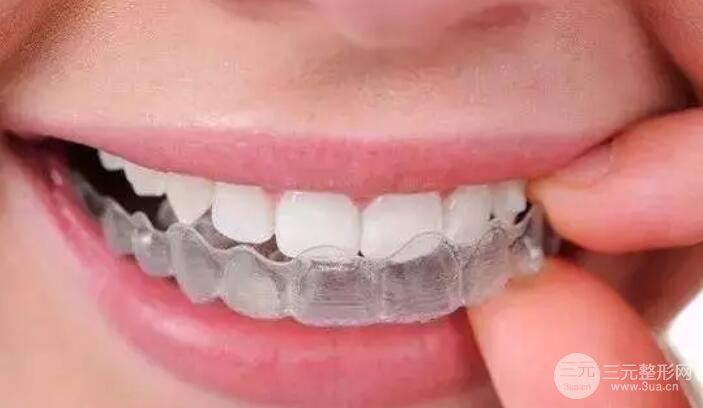 牙齿矫正年龄限制