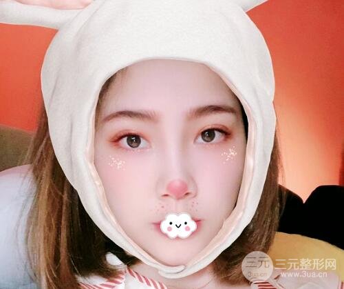 埋线双眼皮一般多少钱