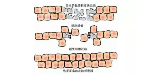 谁做过彩光嫩肤有果吗