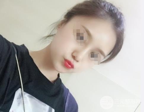 西安美立方整形美容医院怎么样 西安美立方整形美容医院怎么样