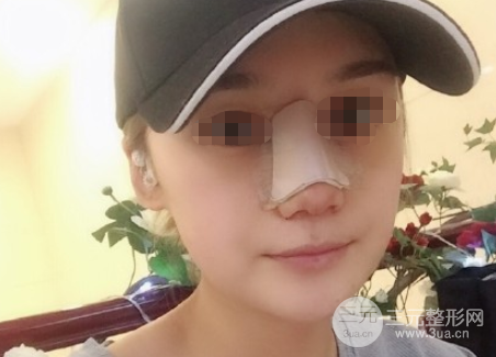 西安美立方整形美容医院怎么样 西安美立方整形美容医院怎么样