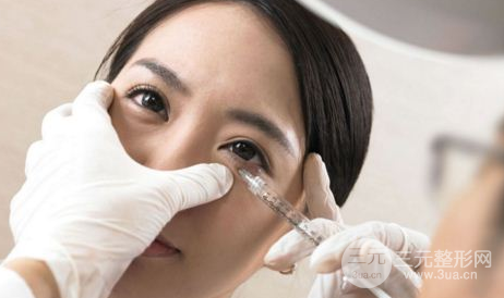 眼袋抽脂术原理及果 眼袋抽脂术原理及果