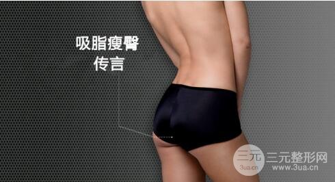 吸脂瘦臀多久才能恢复?恢复时间要多久呢?