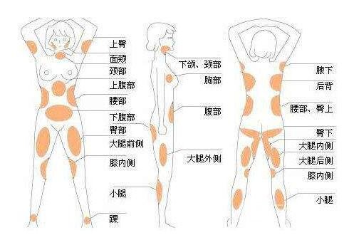 抽脂减肥的危害有哪些?