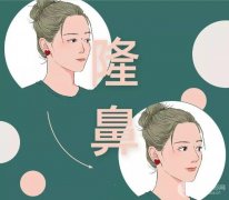 仿生隆鼻是用的什么材料?有没有副作用? 仿生隆鼻是用的什么材料?有没有副作用?