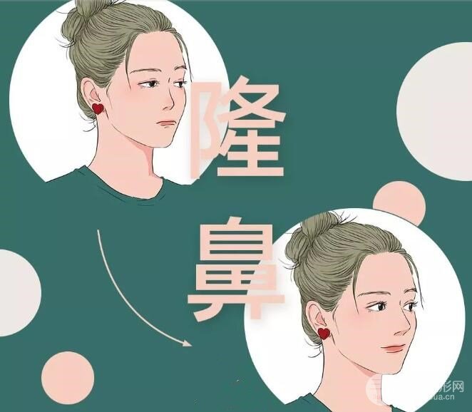 仿生隆鼻是用的什么材料?有没有副作用?