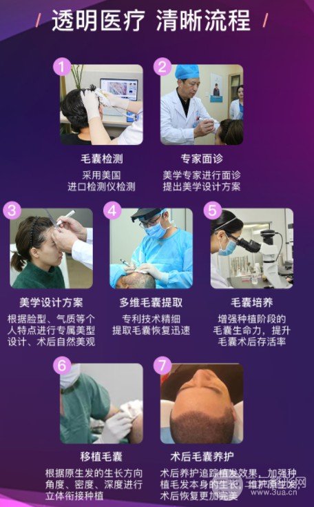 上海碧莲盛植发正规吗?