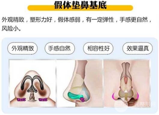 假体垫鼻基底手术原理