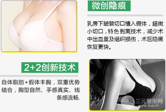 复合隆胸的优点